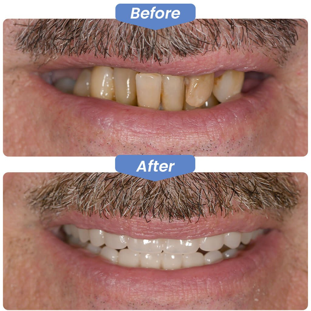 Before-After-Smile-Gallery-2.jpg