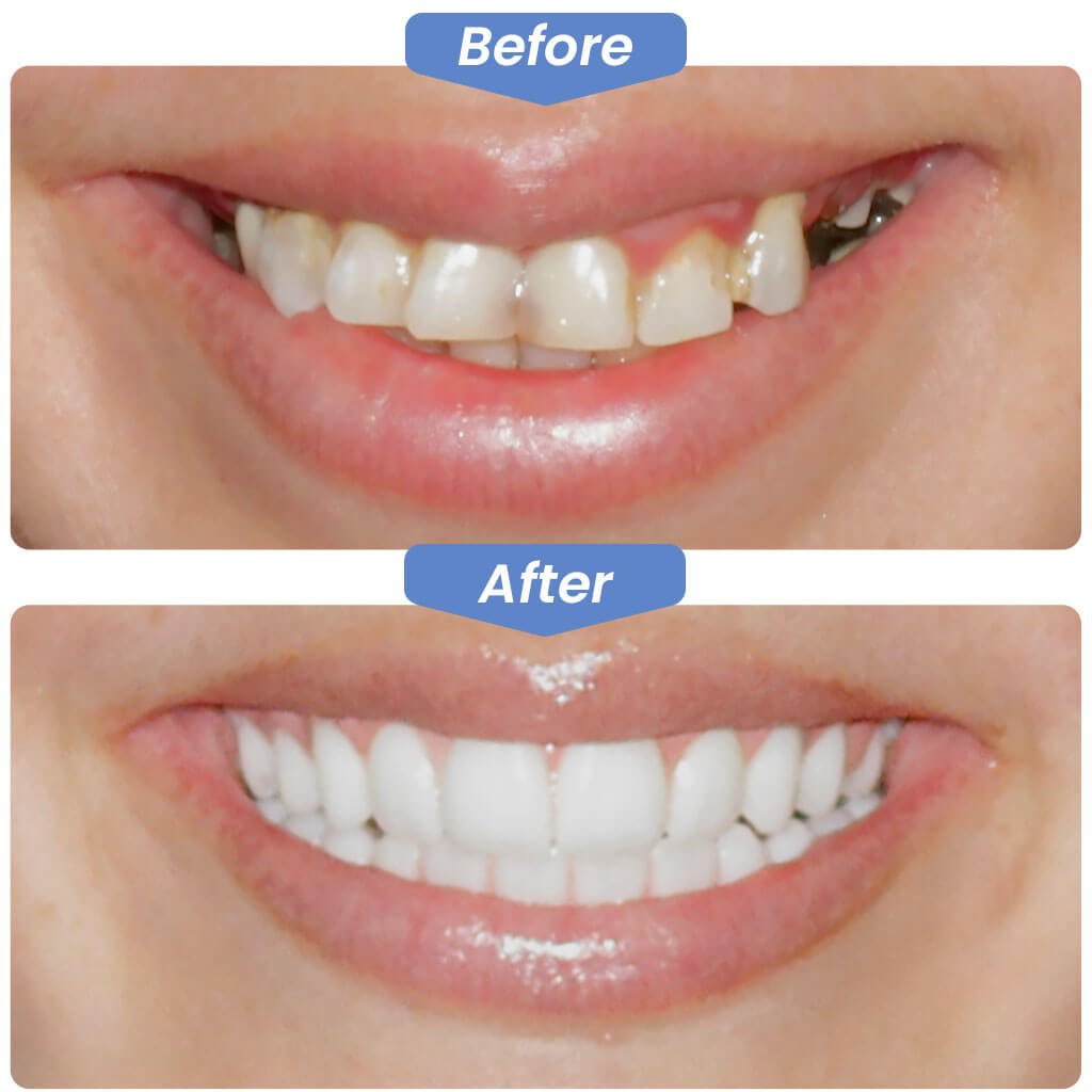 Before-After-Smile-Gallery.jpg